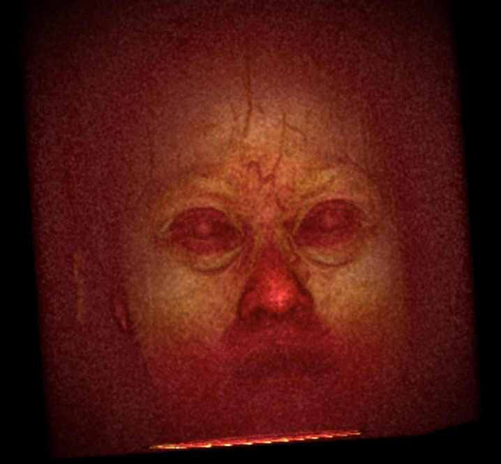 whole head